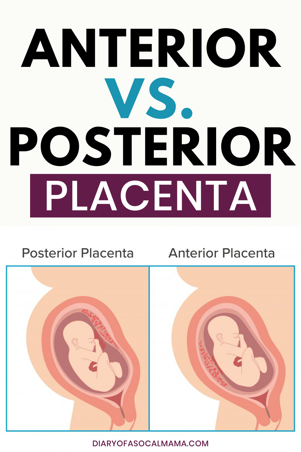 posterior-placenta-means-boy-or-girl