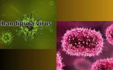 Chandipura virus