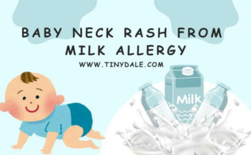 baby neck rash from milk