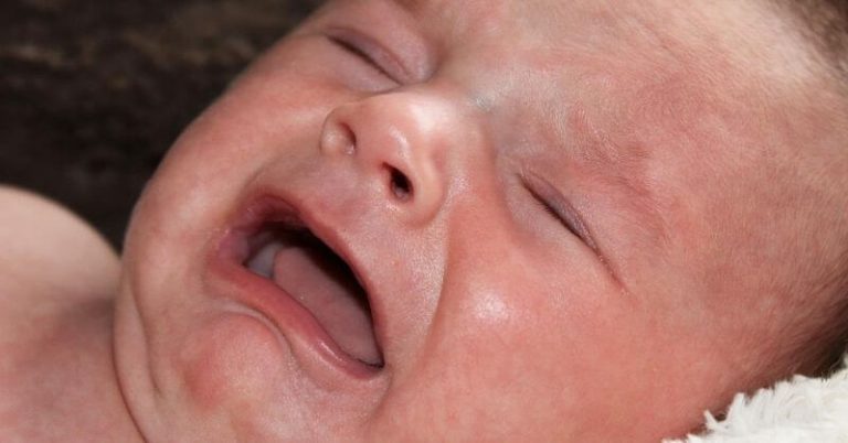 newborn-lip-blister-its-causes-and-treatment